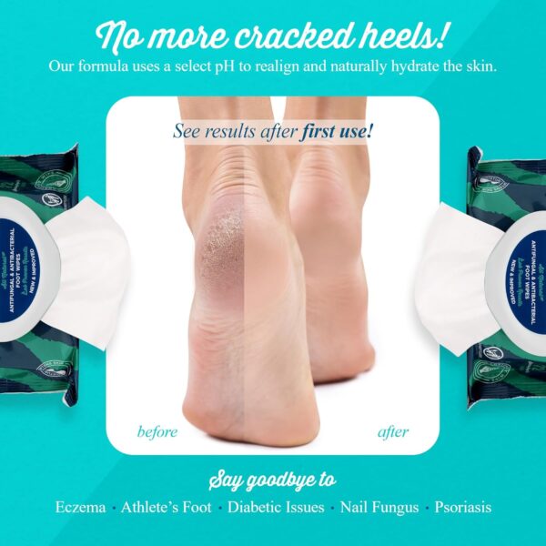 Foot Wipes All-Natural Antifungal & Antibacterial Formula, Cleanses, Moisturizes, Prevents & Kills Athletes Foot, Toenail & Foot Fungus, Odor & Improves Dry, Cracked, Flaky & Diabetic Skin 72ct - Image 4