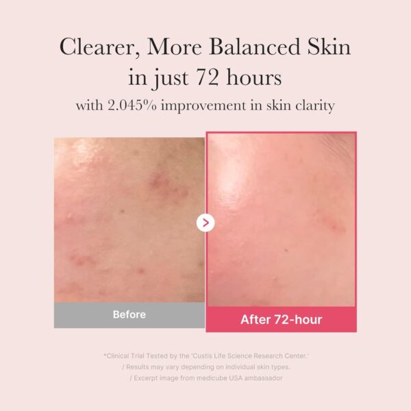 medicube TXA+Niacinamide 15% Glow Facial Serum for After Spot Care | All-in-One Daily Korean Skincare | Uneven Skin Tone, Texture, and Hydration Care | High-Potency Tranexamic Acid 5% | 1.01 fl.oz - Image 5