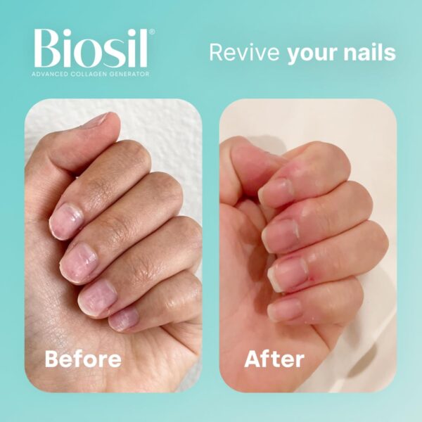 Biosil Collagen Generator - 60 Original Capsules - with Patented ch-OSA Complex - Generates & Protects Your Own Collagen - GMO Free - 30-Day Supply - Image 4