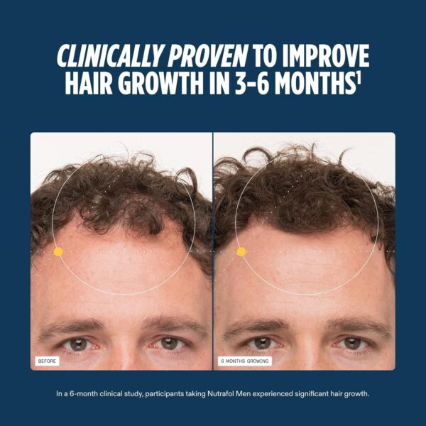 Nutrafol Men's Hair Growth Supplements, Clinically Tested for Visibly Thicker Hair and Scalp Coverage, Dermatologist Recommended - 1 Month Supply - Image 3