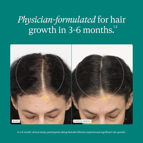 Nutrafol Women's Hair Growth Supplements, Ages 18-44, Clinically Proven for Visibly Thicker and Stronger Hair, Dermatologist Recommended - 1 Month Supply - Image 4