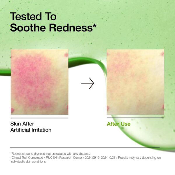Anua Azelaic Acid 10 Hyaluron Redness Soothing Serum, Facial Serum for Sensitive skin, Hyaluronic Acid, Niacinamide, Spot Care, Natural Color, Vegan, Korean Skincare (30ml/ 1.01 fl oz.) - Image 4