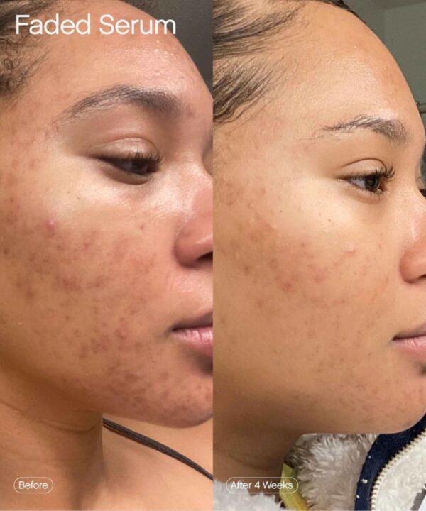 Topicals Faded Brightening and Clearing Serum | Reduces Discoloration Post-Blemish Marks Scars Spots Contains Kojic Acid Niacinamide Dermatologist-tested Vegan Cruelty-Free Fl Oz - Image 3