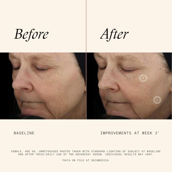 SkinMedica TNS Advanced+ Serum - Our Premium Facial Skin Care Product, the Secret to Flawless Skin. Age-Defying Face Serum for Women is Proven to Address Wrinkles and Fine Lines for Glowing Skin,1 Oz - Image 3