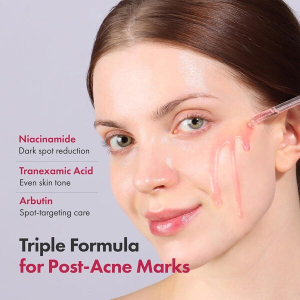 Niacinamide 10% + Tranexamic Acid 4% Serum, Arbutin 2%, Hyaluronic Acid, TXA Facial Serum, Glass Skin, Clarifying, Radiant Complexion with Natural Color, Korean Skin care, 33ml, 1.11 fl.oz. - Image 5