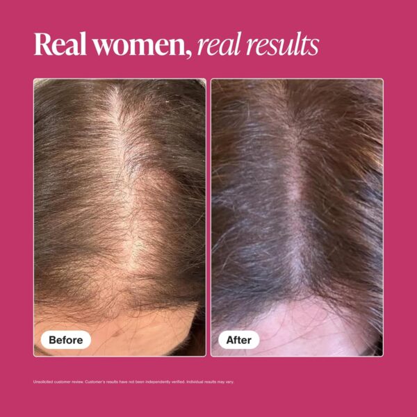 Viviscal Hair Growth Supplements For Women For Thicker, Fuller Hair, Nourishes Thinning & Loss, With Proprietary Collagen Complex, 180 Tablets, 3 Month Supply - Image 5